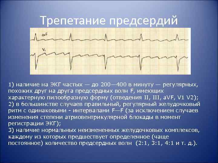 Трепетание предсердий 1) наличие на ЭКГ частых — до 200— 400 в минуту —