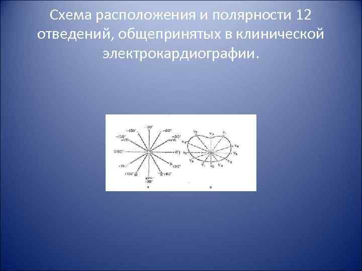 Схема расположения и полярности 12 отведений, общепринятых в клинической электрокардиографии. 