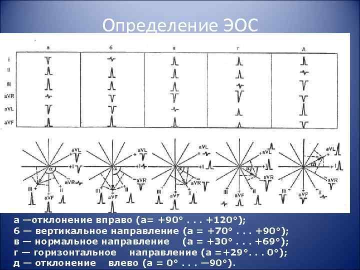 Определение ЭОС а —отклонение вправо (а= +90°. . . +120°); 6 — вертикальное направление