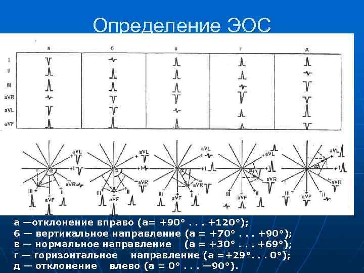 Определение ЭОС а —отклонение вправо (а= +90°. . . +120°); 6 — вертикальное направление