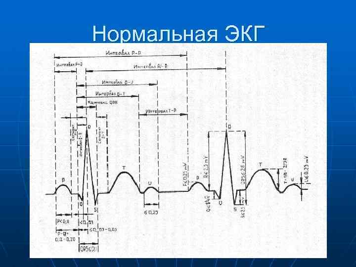 Нормальная ЭКГ 