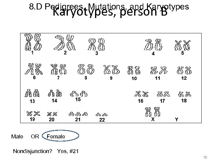 8. D Pedigrees, Mutations, and Karyotypes, person B Male OR Female Nondisjunction? Yes, #21