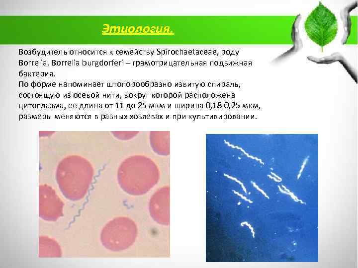 Этиология. Возбудитель относится к семейству Spirochaetaceae, роду Borrelia burgdorferi – грамотрицательная подвижная бактерия. По