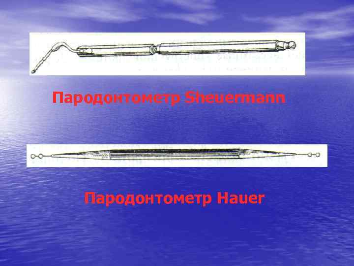 Пародонтометр Sheuermann Пародонтометр Hauer 