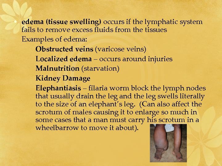  • edema (tissue swelling) occurs if the lymphatic system fails to remove excess