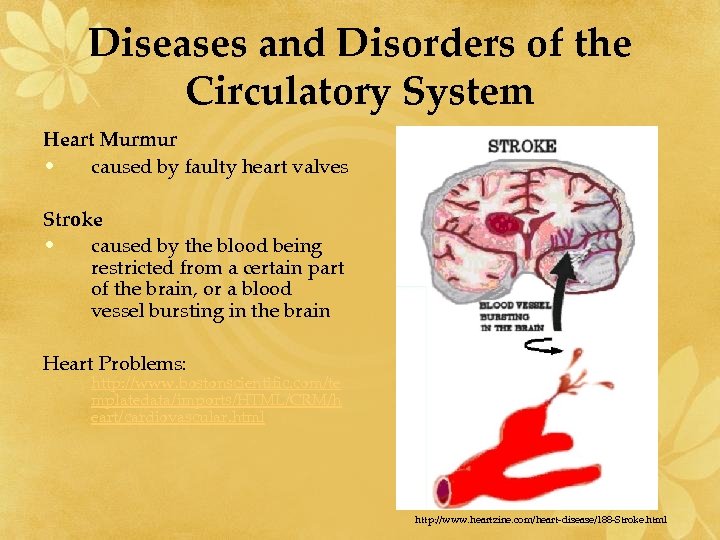 Diseases and Disorders of the Circulatory System Heart Murmur • caused by faulty heart