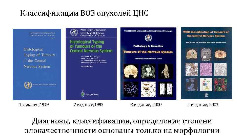 Классификации ВОЗ опухолей ЦНС 1 издание, 1979 2 издание, 1993 3 издание, 2000 4