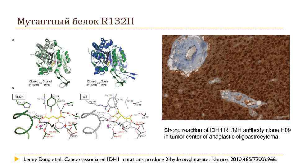 Мутантный белок R 132 H Strong reaction of IDH 1 R 132 H antibody