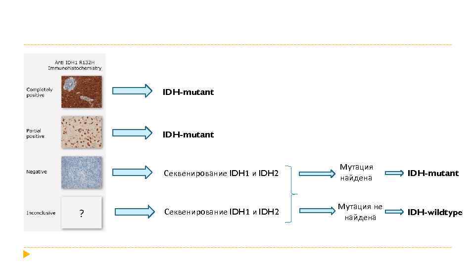 IDH-mutant Секвенирование IDH 1 и IDH 2 Мутация найдена IDH-mutant Секвенирование IDH 1 и