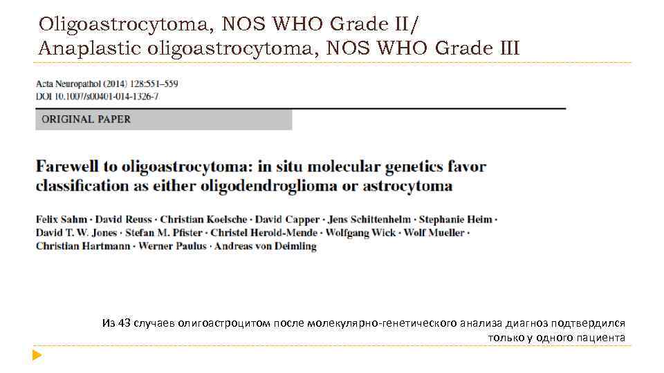 Oligoastrocytoma, NOS WHO Grade II/ Anaplastic oligoastrocytoma, NOS WHO Grade III Из 43 случаев