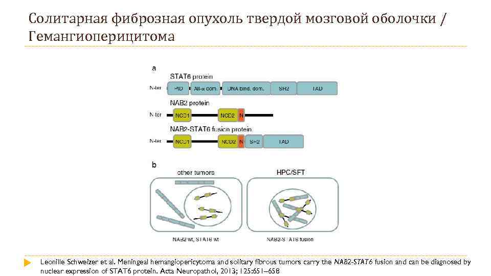 Солитарная фиброзная опухоль твердой мозговой оболочки / Гемангиоперицитома Leonille Schweizer et al. Meningeal hemangiopericytoma