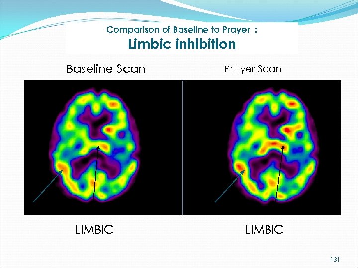 Comparison of Baseline to Prayer : Limbic inhibition Baseline Scan LIMBIC Prayer Scan LIMBIC