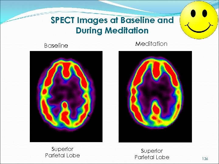 SPECT Images at Baseline and During Meditation Baseline Meditation Superior Parietal Lobe 136 