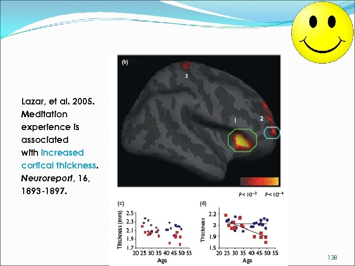 Lazar, et al. 2005. Meditation experience is associated with increased cortical thickness. Neuroreport, 16,