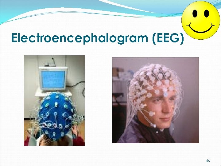 Electroencephalogram (EEG) 46 