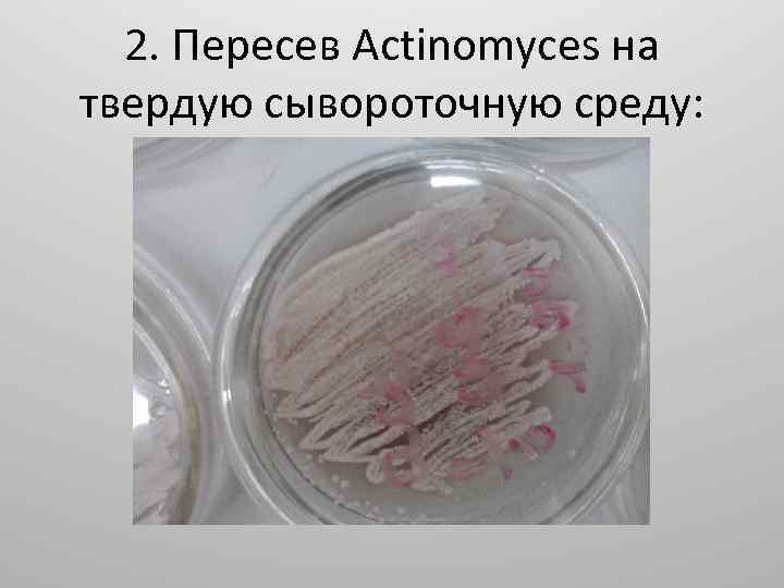 2. Пересев Actinomyces на твердую сывороточную среду: 