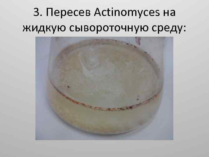 3. Пересев Actinomyces на жидкую сывороточную среду: 