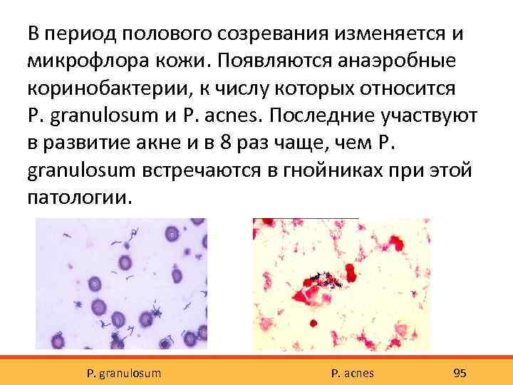 В период полового созревания изменяется и микрофлора кожи. Появляются анаэробные коринобактерии, к числу которых