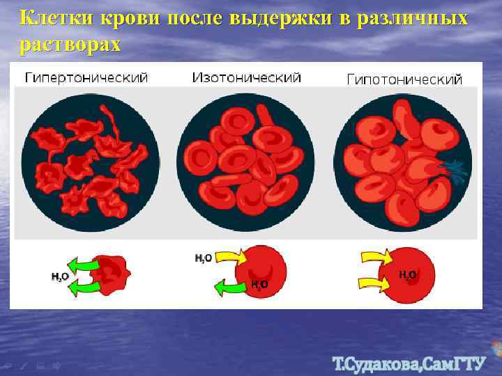 Клетки крови после выдержки в различных растворах 