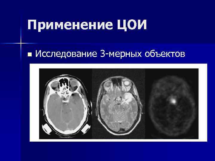 Применение ЦОИ n Исследование 3 -мерных объектов 