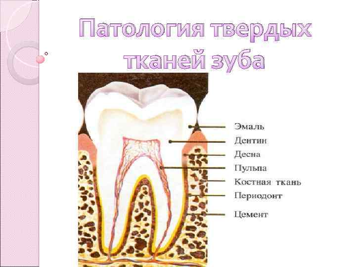 Патология твердых тканей зуба 