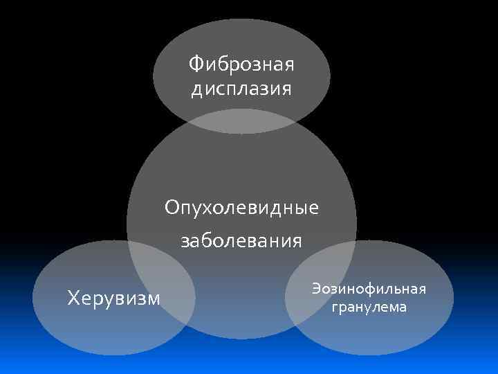 Фиброзная дисплазия Опухолевидные заболевания Херувизм Эозинофильная гранулема 