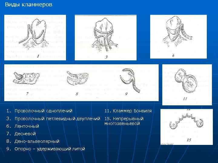 Кламмерная система нея презентация