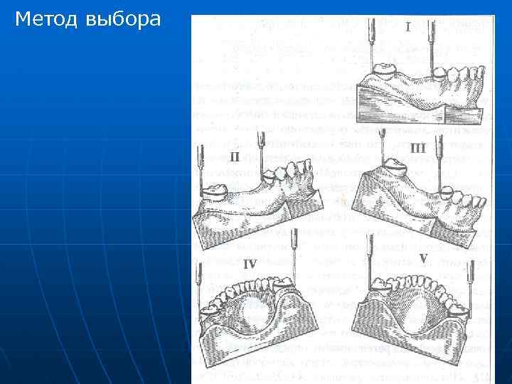 Метод выбора 