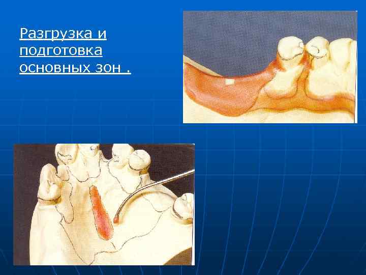 Разгрузка и подготовка основных зон. 