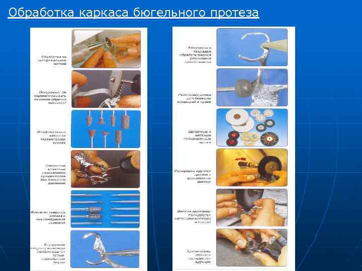 Обработка каркаса бюгельного протеза 