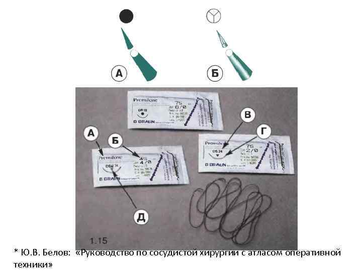 * Ю. В. Белов: «Руководство по сосудистой хирургии с атласом оперативной техники» 