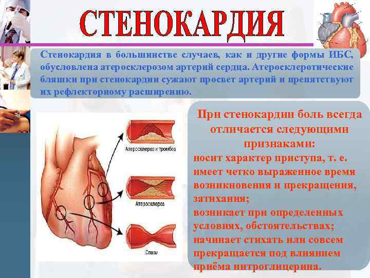 Стенокардия в большинстве случаев, как и другие формы ИБС, обусловлена атеросклерозом артерий сердца. Атеросклеротические