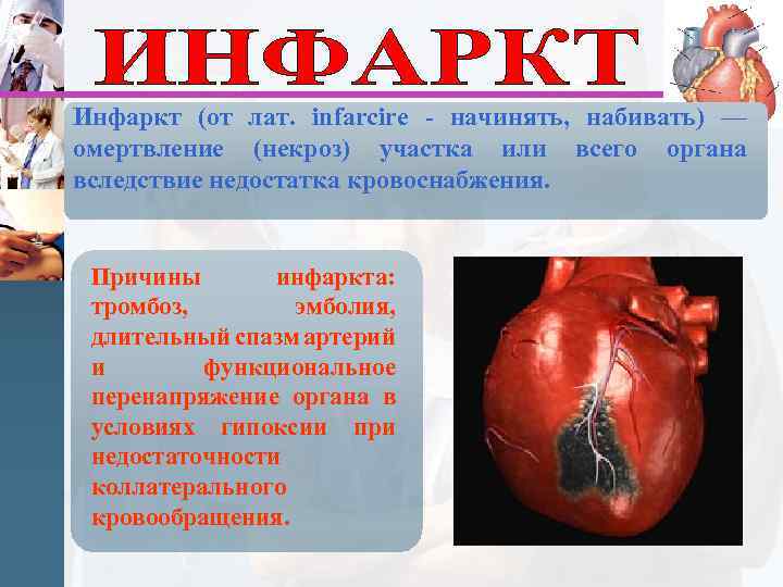 Инфаркт (от лат. infarcire - начинять, набивать) — омертвление (некроз) участка или всего органа