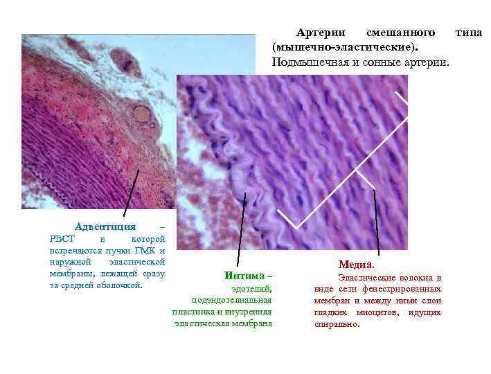 Артерии смешанного типа (мышечно-эластические). Подмышечная и сонные артерии. Адвентиция – РВСТ в которой встречаются