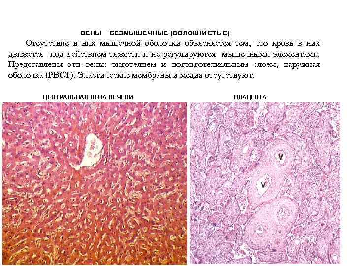 ВЕНЫ БЕЗМЫШЕЧНЫЕ (ВОЛОКНИСТЫЕ) Отсутствие в них мышечной оболочки объясняется тем, что кровь в них