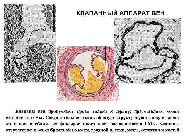 КЛАПАННЫЙ АППАРАТ ВЕН Клапаны вен пропускают кровь только к сердцу; представляют собой складки интимы.