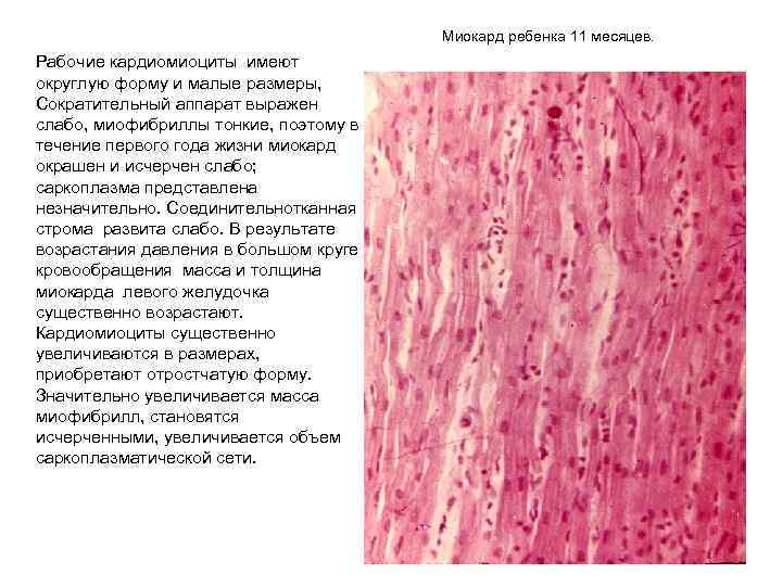 Миокард ребенка 11 месяцев. Рабочие кардиомиоциты имеют округлую форму и малые размеры, Сократительный аппарат