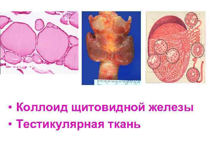  • Коллоид щитовидной железы • Тестикулярная ткань 