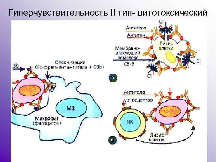 Типы гиперчувствительности. 2 Тип гиперчувствительности схема. Схема реакции гиперчувствительности 2 типа. Реакция гиперчувствительности 2 типа. Механизм гиперчувствительности 2 типа.