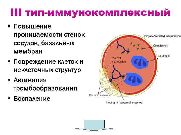 Схема иммунокомплексного повреждения клубочков