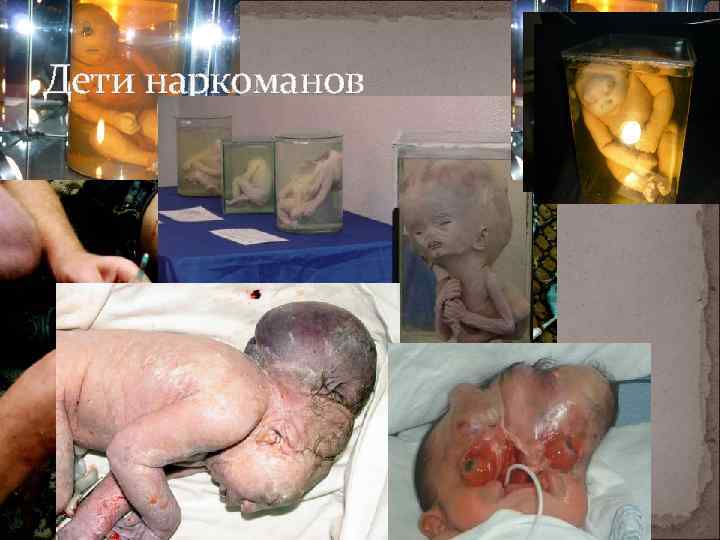 Дети наркоманов 