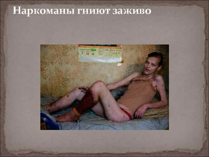 Наркоманы гниют заживо 