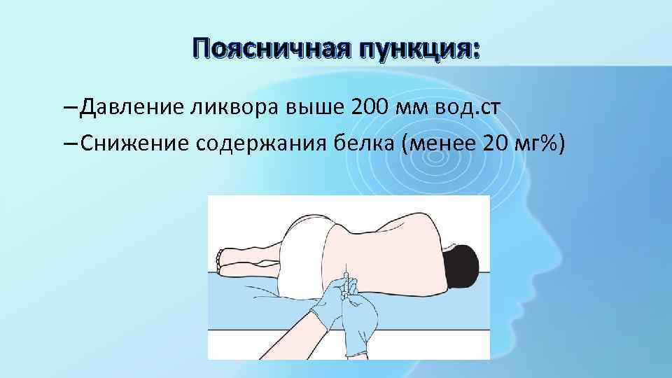 Поясничная пункция: – Давление ликвора выше 200 мм вод. ст – Снижение содержания белка
