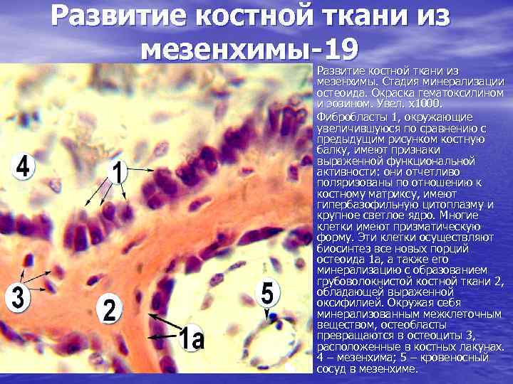 Развитие костной ткани из мезенхимы-19 • Развитие костной ткани из • мезенхимы. Стадия минерализации