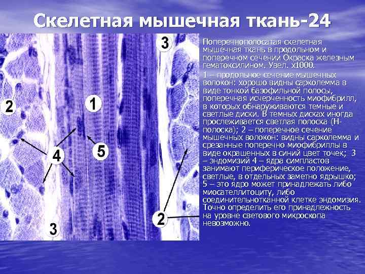 Многоядерная ткань. Поперечнополосатая Скелетная мышечная ткань языка препарат. Поперечнополосатая мышечная ткань языка кролика гистология. Поперечнополосатая Скелетная мышечная ткань препарат. Волокно скелетной мышечной ткани препарат.