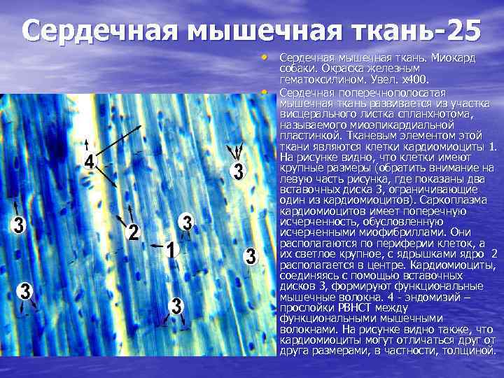 Сердечная мышечная ткань-25 • Сердечная мышечная ткань. Миокард • собаки. Окраска железным гематоксилином. Увел.