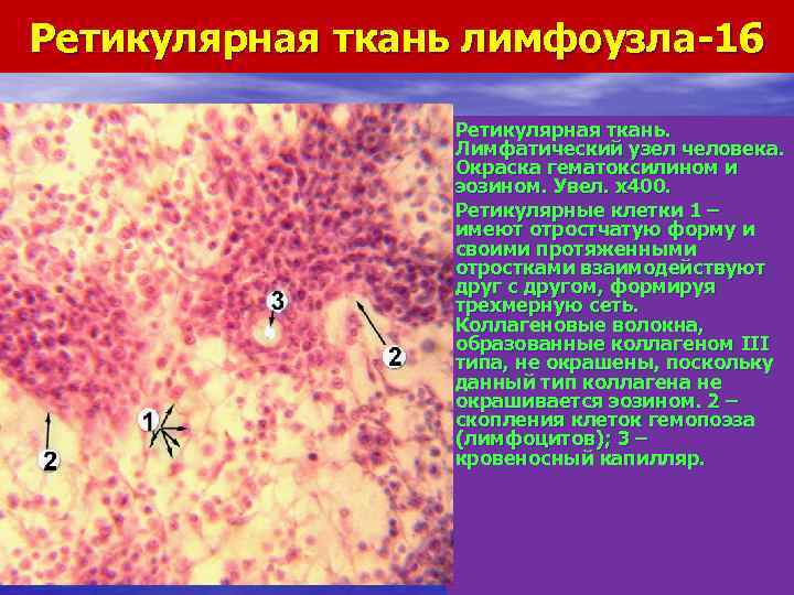 Ретикулярная ткань. Ретикулярная ткань лимфатического узла. Ретикулярная ткань гематоксилин-эозин.