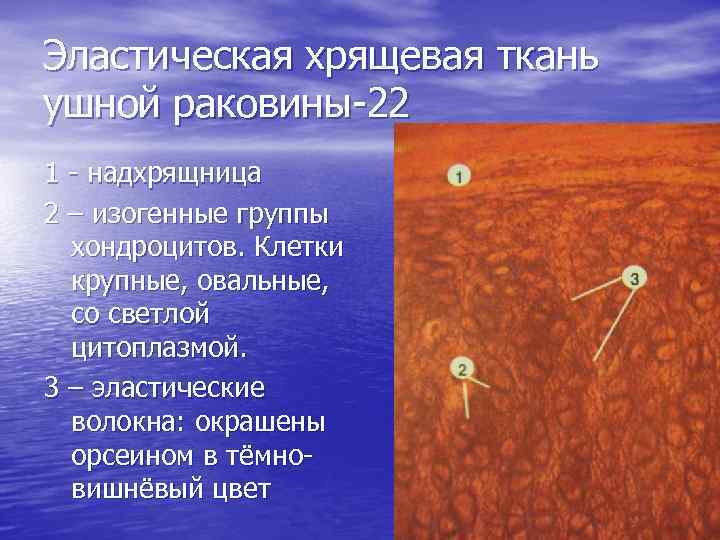 Эластическая хрящевая ткань ушной раковины-22 1 - надхрящница 2 – изогенные группы хондроцитов. Клетки