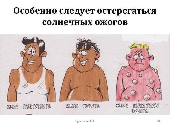 Особенно следует остерегаться солнечных ожогов Гудинова Ж. В. 73 