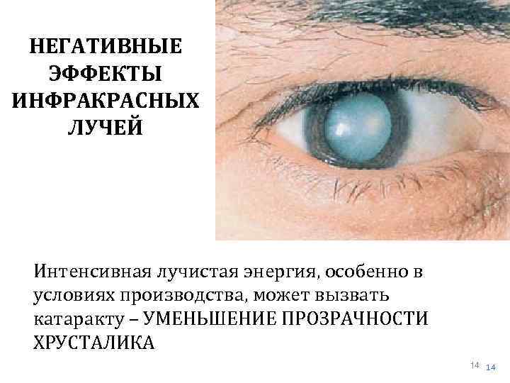 НЕГАТИВНЫЕ ЭФФЕКТЫ ИНФРАКРАСНЫХ ЛУЧЕЙ Интенсивная лучистая энергия, особенно в условиях производства, может вызвать катаракту